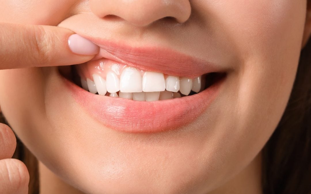 Signs Your Gums Need Help x Signs Your Gums Need Help x