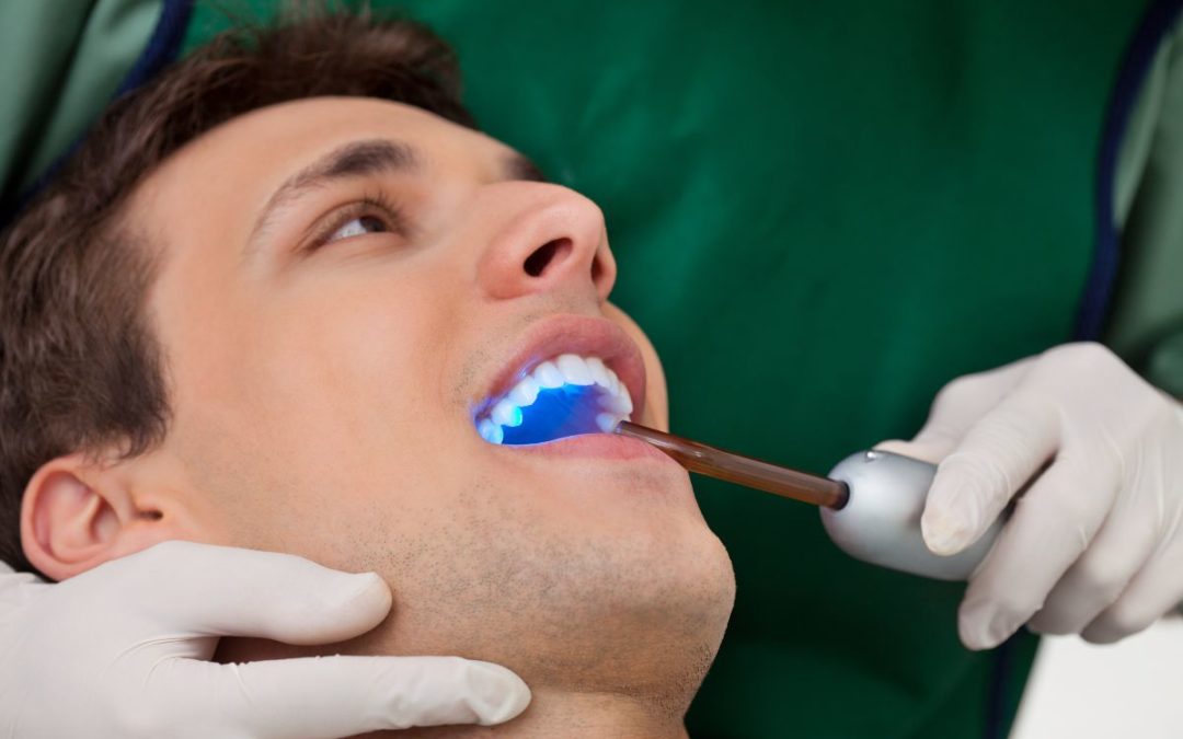 What Causes Cavities?